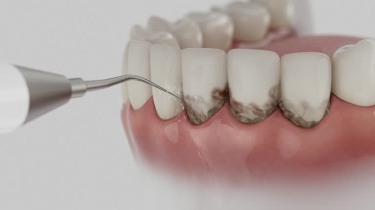 Trusted Teeth Cleaning And Checkup service in Fountain Inn, SC - Dentist Open Now